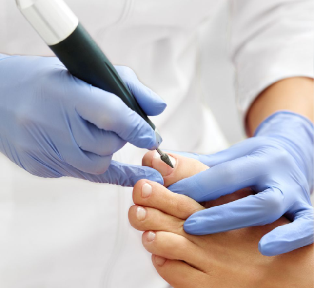 Podologia preventiva e outros tratamentos em Belo Horizonte